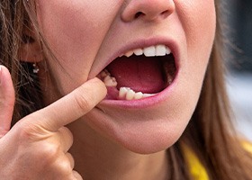 Closeup of a missing tooth