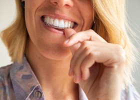 Woman putting in her aligners