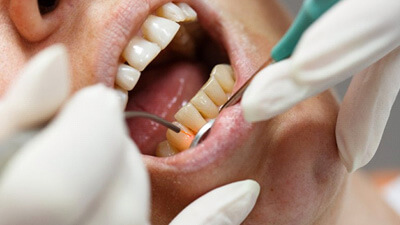 a patient undergoing dental lase treatment